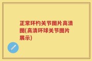 正常环杓关节图片高清图(高清环球关节图片展示)