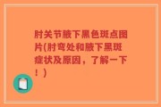 肘关节腋下黑色斑点图片(肘弯处和腋下黑斑症状及原因，了解一下！)