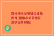 腰椎间小关节错位症状图片(腰椎小关节错位症状图片解析)