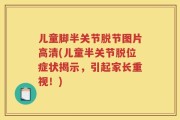 儿童脚半关节脱节图片高清(儿童半关节脱位症状揭示，引起家长重视！)