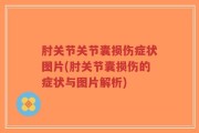肘关节关节囊损伤症状图片(肘关节囊损伤的症状与图片解析)