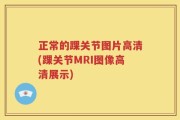 正常的踝关节图片高清(踝关节MRI图像高清展示)