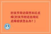 肘关节旁边突然长红点痒(肘关节附近出现红点痒症状怎么办？)