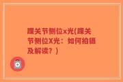 踝关节侧位x光(踝关节侧位X光：如何拍摄及解读？)