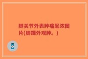 脚关节外表肿痛起浓图片(脚踝外观肿。)