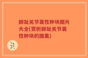 脚趾关节囊性肿块图片大全(赏析脚趾关节囊性肿块的图集)
