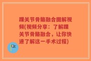 踝关节骨骼融合图解视频(视频分享：了解踝关节骨骼融合，让你快速了解这一手术过程)