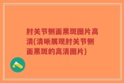 肘关节侧面黑斑图片高清(清晰展现肘关节侧面黑斑的高清图片)