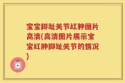 宝宝脚趾关节红肿图片高清(高清图片展示宝宝红肿脚趾关节的情况)
