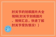 肘关节的划痕图片大全视频(肘关节划痕图片、视频汇总，快速了解肘关节受伤情况！)