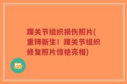 踝关节组织损伤照片(重铸新生！踝关节组织修复照片惊艳亮相)