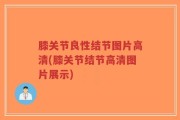 膝关节良性结节图片高清(膝关节结节高清图片展示)