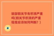 腿部髋关节有积液严重吗(髋关节积液的严重程度应该如何判断？)