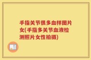 手指关节很多血样图片女(手指多关节血液检测照片女性拍摄)