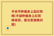手关节肿痛身上起红斑痒(手部肿痛身上红斑痒症状，需注意健康问题)