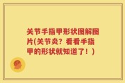 关节手指甲形状图解图片(关节炎？看看手指甲的形状就知道了！)