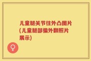 儿童腿关节往外凸图片(儿童腿部偏外翻照片展示)