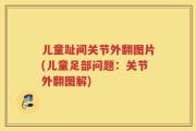 儿童趾间关节外翻图片(儿童足部问题：关节外翻图解)