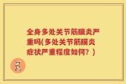 全身多处关节筋膜炎严重吗(多处关节筋膜炎症状严重程度如何？)