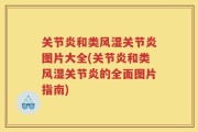 关节炎和类风湿关节炎图片大全(关节炎和类风湿关节炎的全面图片指南)