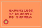 踝关节韧带怎么缝合的图片(如何缝合踝关节韧带：详细步骤图解)