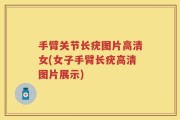 手臂关节长疣图片高清女(女子手臂长疣高清图片展示)
