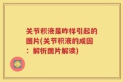 关节积液是咋样引起的图片(关节积液的成因：解析图片解读)
