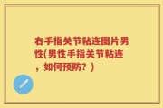 右手指关节粘连图片男性(男性手指关节粘连，如何预防？)