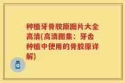 种植牙骨胶原图片大全高清(高清图集：牙齿种植中使用的骨胶原详解)