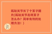 跖趾关节长了个茧子图片(跖趾关节出现茧子怎么办？简单有效的处理方法！)