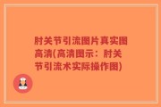肘关节引流图片真实图高清(高清图示：肘关节引流术实际操作图)