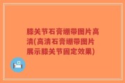 膝关节石膏绷带图片高清(高清石膏绷带图片展示膝关节固定效果)