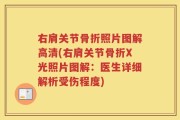 右肩关节骨折照片图解高清(右肩关节骨折X光照片图解：医生详细解析受伤程度)