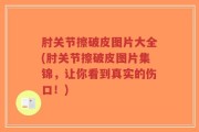 肘关节擦破皮图片大全(肘关节擦破皮图片集锦，让你看到真实的伤口！)