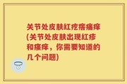 关节处皮肤红疙瘩痛痒(关节处皮肤出现红疹和瘙痒，你需要知道的几个问题)