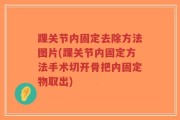 踝关节内固定去除方法图片(踝关节内固定方法手术切开骨把内固定物取出)