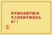 关节部位皮肤干癣(关节上的皮肤干癣该怎么办？)