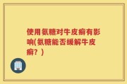 使用氨糖对牛皮癣有影响(氨糖能否缓解牛皮癣？)