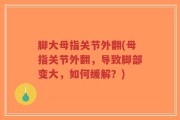 脚大母指关节外翻(母指关节外翻，导致脚部变大，如何缓解？)