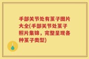 手部关节处有茧子图片大全(手部关节处茧子照片集锦，完整呈现各种茧子类型)