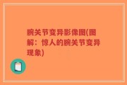 腕关节变异影像图(图解：惊人的腕关节变异现象)
