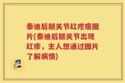 泰迪后腿关节红疙瘩图片(泰迪后腿关节出现红疹，主人想通过图片了解病情)