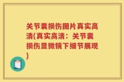 关节囊损伤图片真实高清(真实高清：关节囊损伤显微镜下细节展现)