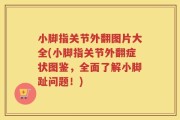 小脚指关节外翻图片大全(小脚指关节外翻症状图鉴，全面了解小脚趾问题！)