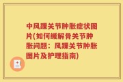 中风踝关节肿胀症状图片(如何缓解骨关节肿胀问题：风踝关节肿胀图片及护理指南)