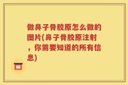 做鼻子骨胶原怎么做的图片(鼻子骨胶原注射，你需要知道的所有信息)