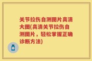 关节拉伤自测图片高清大图(高清关节拉伤自测图片，轻松掌握正确诊断方法)