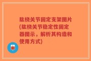 肱桡关节固定支架图片(肱桡关节稳定性固定器图示，解析其构造和使用方式)