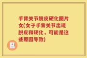 手背关节脱皮硬化图片女(女子手背关节出现脱皮和硬化，可能是这些原因导致)