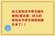 幼儿寰枢关节牵引图片视频(看这里！幼儿的寰枢关节牵引视频和图片来了！)